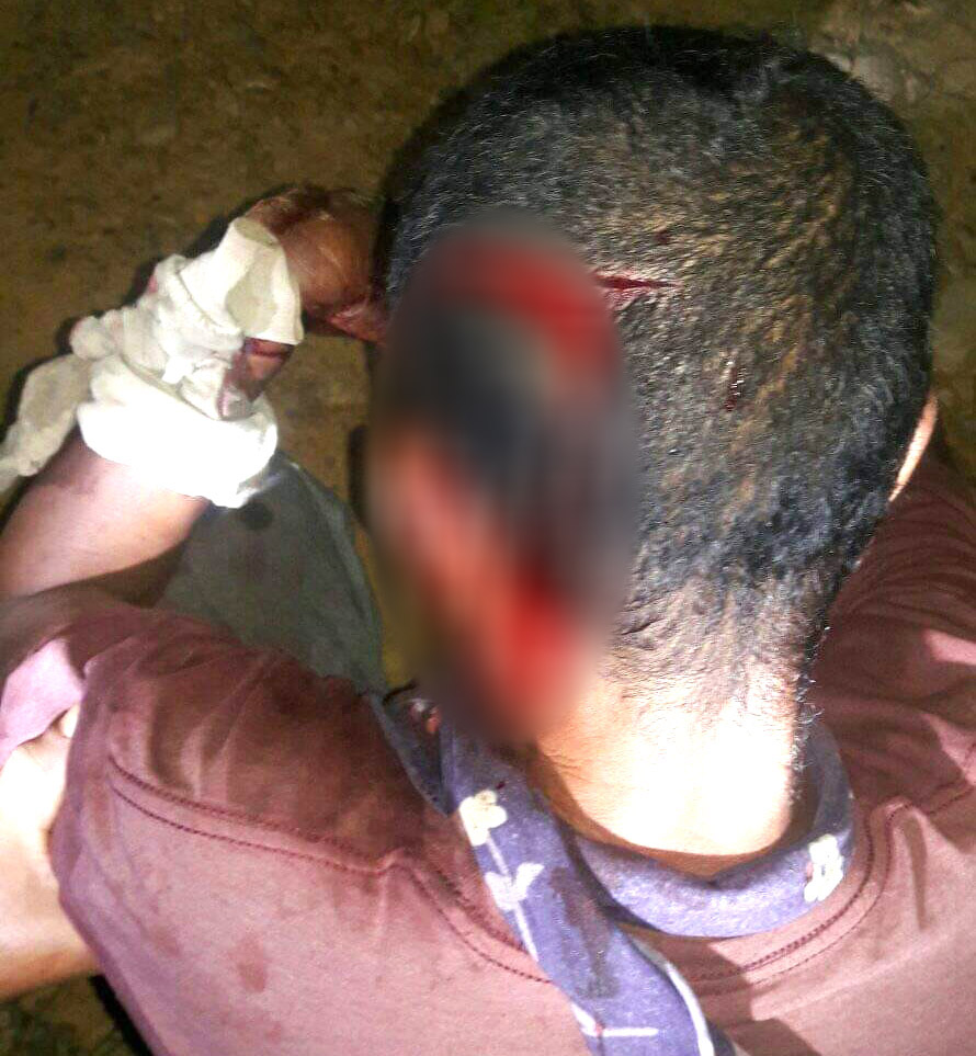 ५० बर्षिय सुक बहादुरको बन्चरो बितण्डा, एकको मृत्यु दुई घाइते