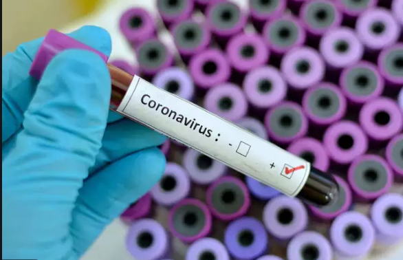 २४ घण्टामा ३ हजार २६० जनामा कोरोना संक्रमण पुष्टि
