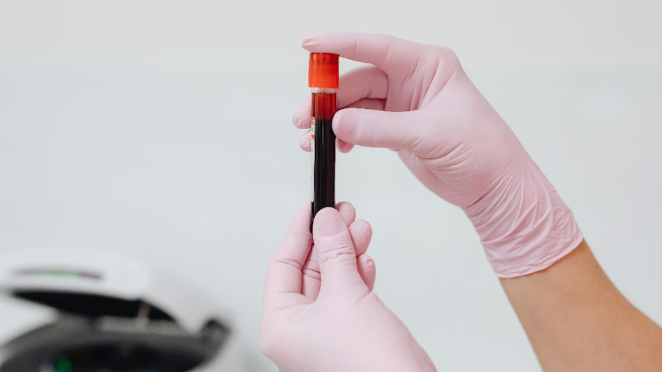 भारतीय महिलामा भेटियो सबैभन्दा दुर्लभ रक्त समूह, आश्चर्यमा विश्वका वैज्ञानिकहरु