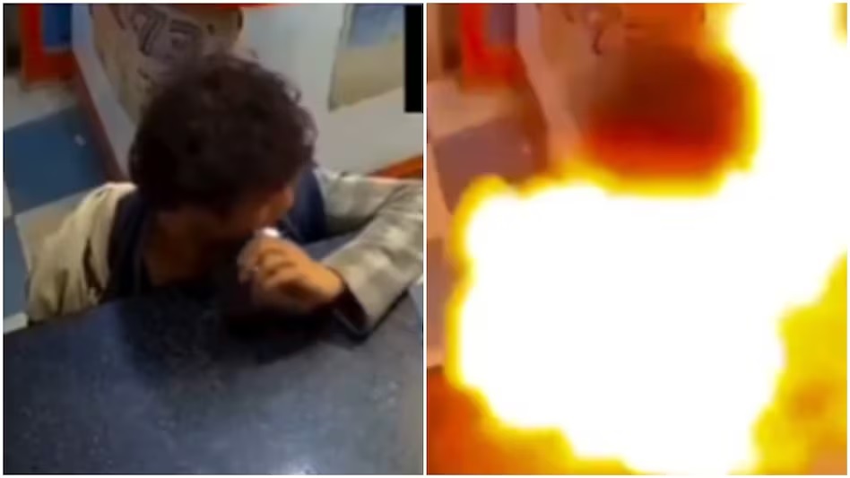 Smartphone battery explodes in young man’s mouth, don’t forget this mistake